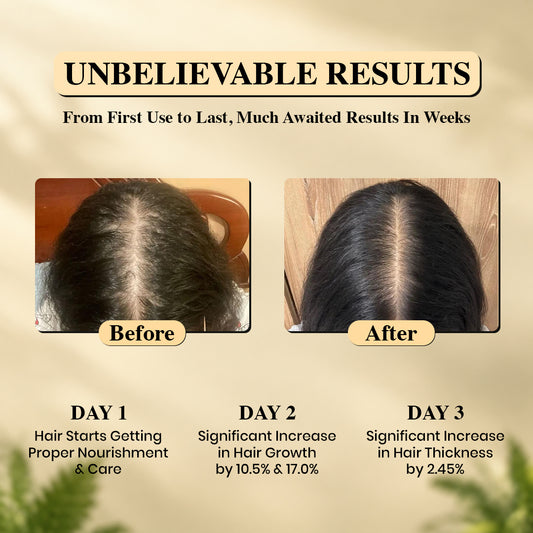 Best Hair oil in Pakistan | Hair Growth Oil (200ml)
